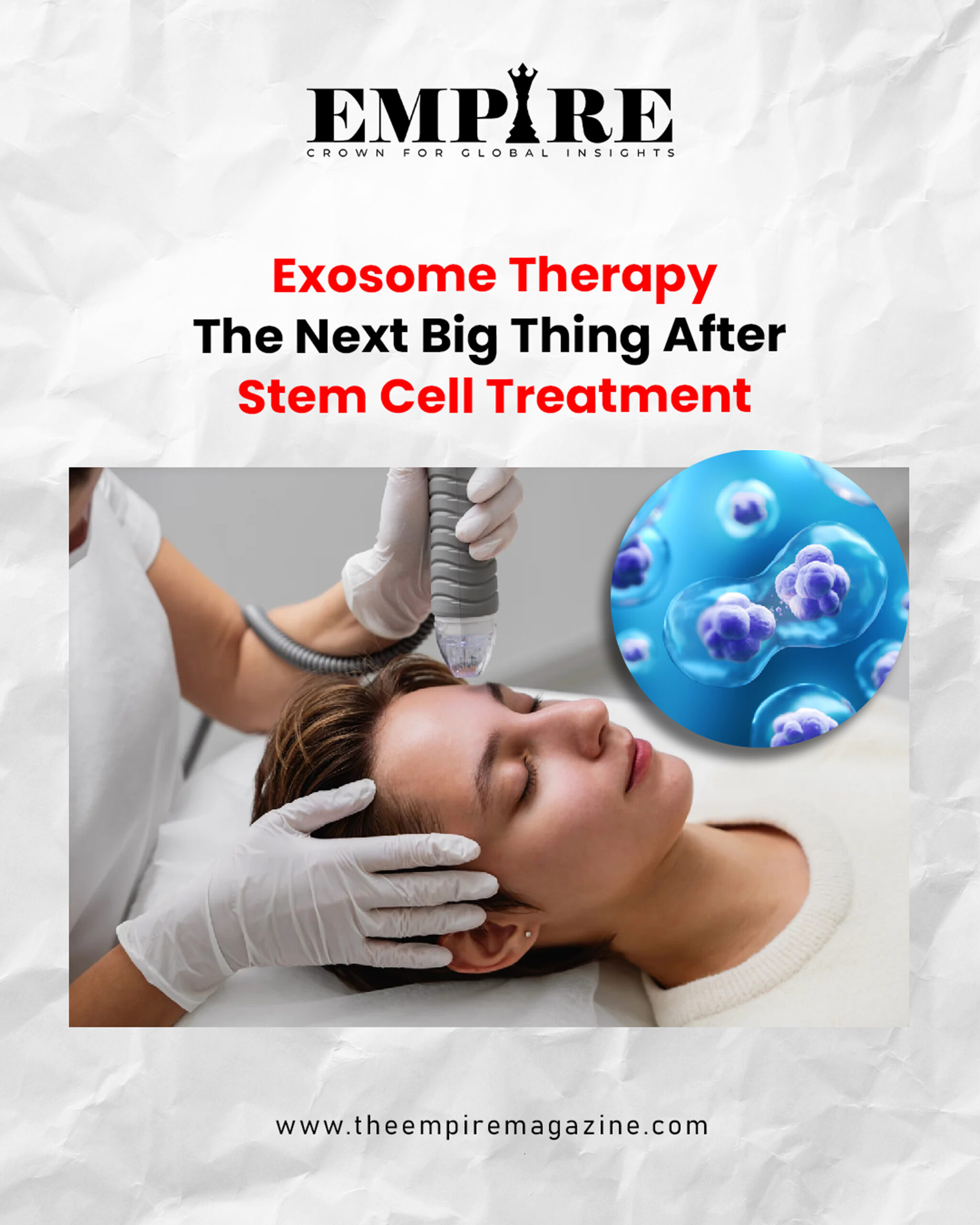 Exosome Therapy
