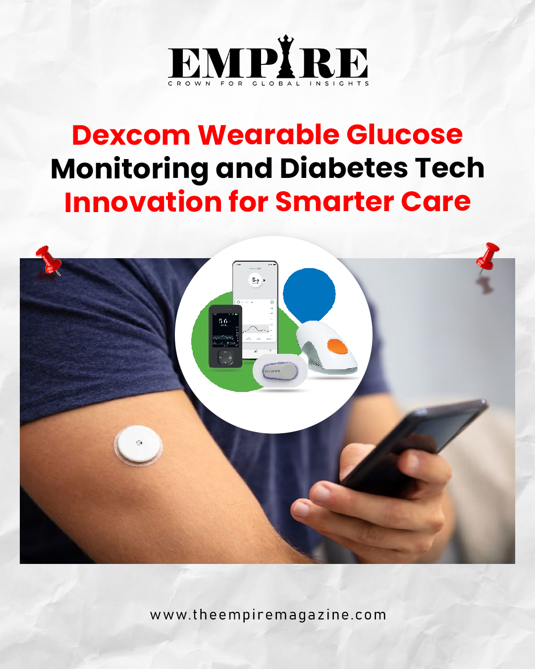 Dexcom
